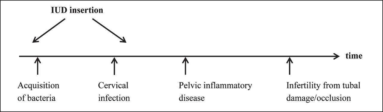 Aetiology of infection with intrauterine device (IUD).